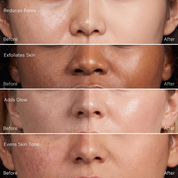 Niacinamide Toner Pads